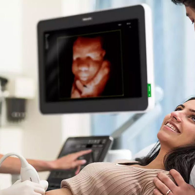 Ультразвуковая система премиального класса Philips EPIQ Elite